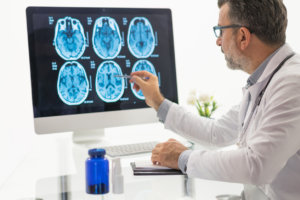 Male doctor looking over brain scans of a brain injury.