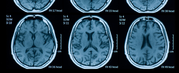 digital scans revealing a brain injury