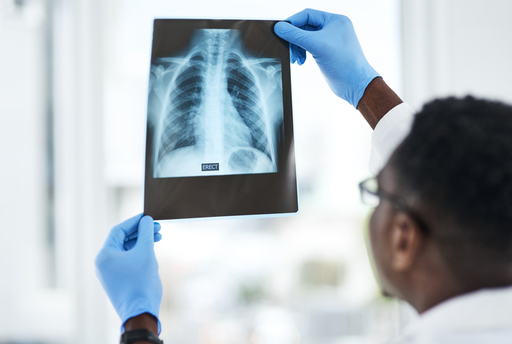 Doctor holding up rib x-ray